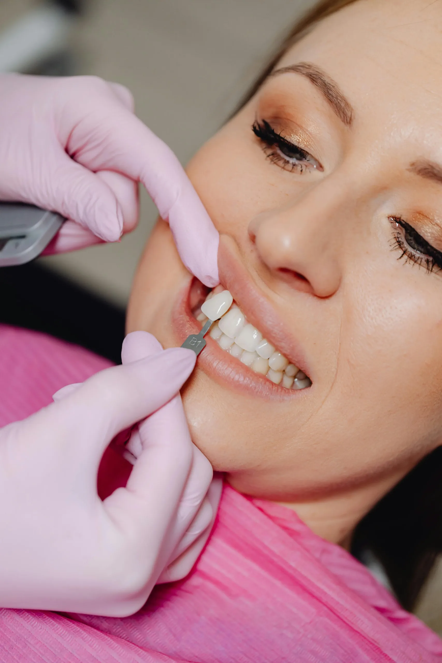 Εμφυτεύματα Δοντιών για φυσικό χαμόγελο – Dental Room